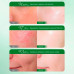 Сыворотка с оливковым маслом и маслом семян белой пены Sadoer Olives Oil luxury soothing essential oil 30 мл питание и восстановление кожи